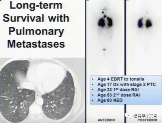 甲状腺癌术后 补硒