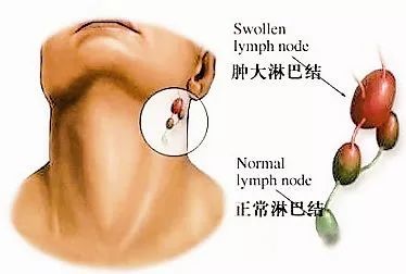 白带反复可以补硒吗