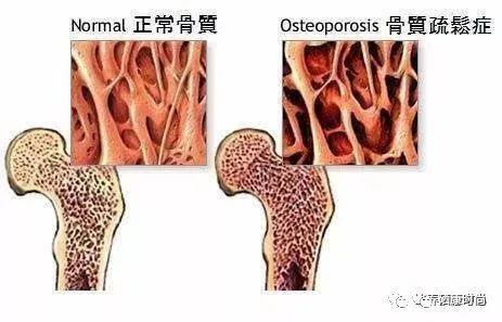 儿童硒元素低怎么补