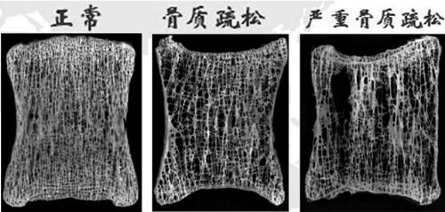 吃什么可以补钙