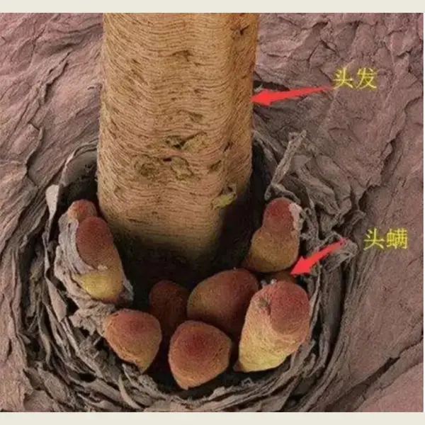 肝炎补硒200毫克