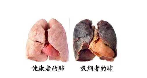 脑梗死补硒有益处吗