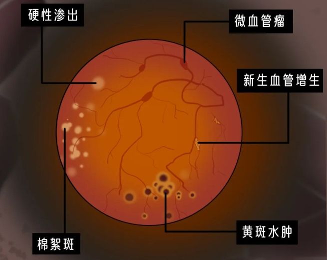 增进抗龋齿能力的最主要微量元素是