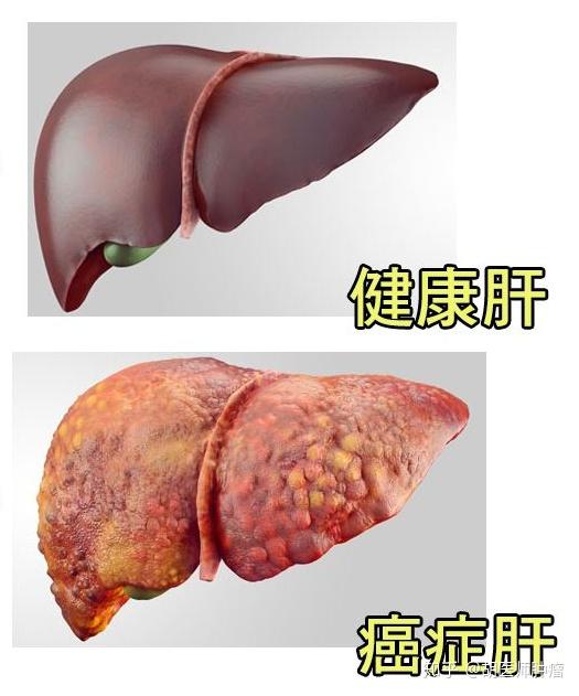 缺硒会上火吗怎么补