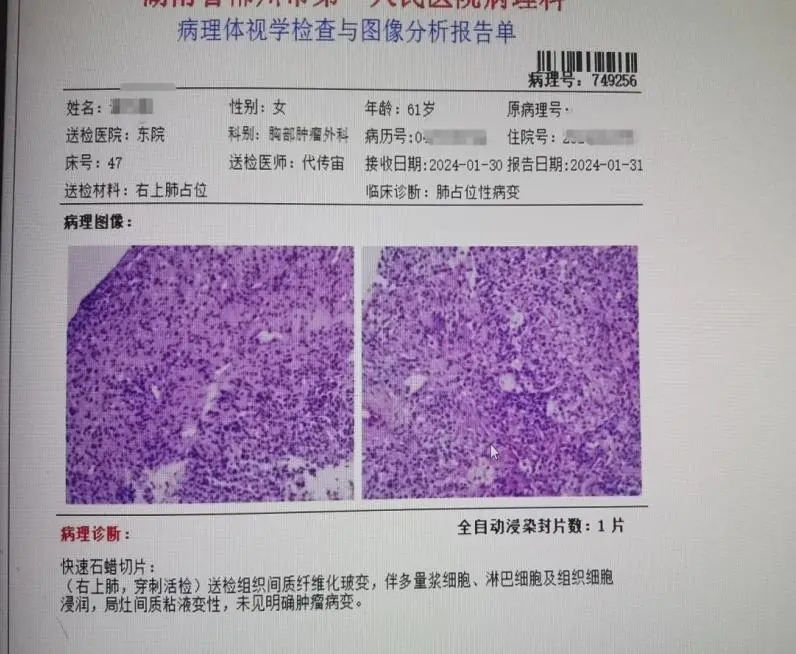 乳腺癌患者补硒好吗