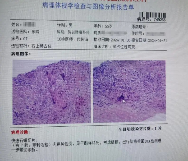 乳腺癌患者补硒好吗