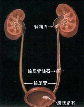 骨折需要补钙吗