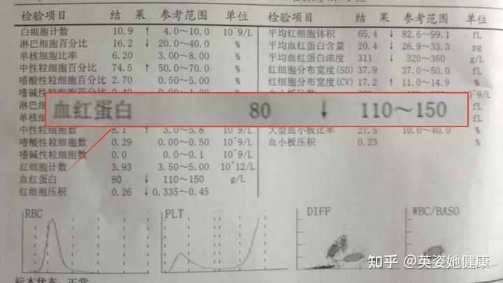 孕妇一定要补铁吗