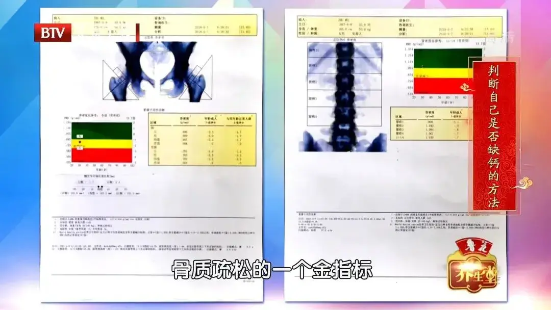 维生素d能补钙吗