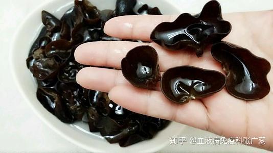 什么食物能补铁