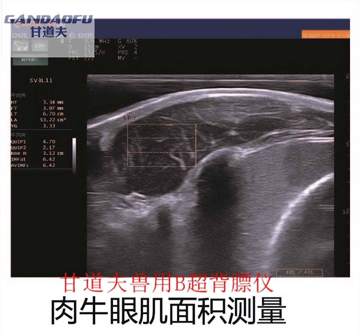 医用微量元素测定仪