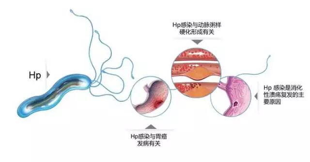 胃病患者可以补硒吗