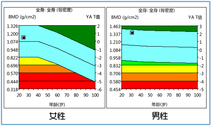 50岁补钙吃什么牌子的钙片好