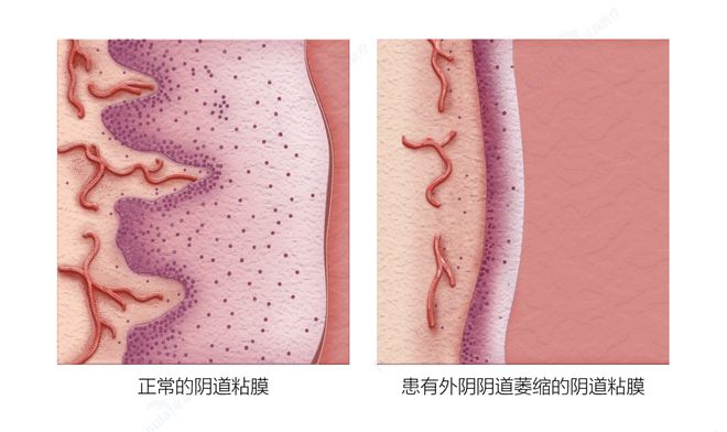 吃锌硒能补雌激素吗