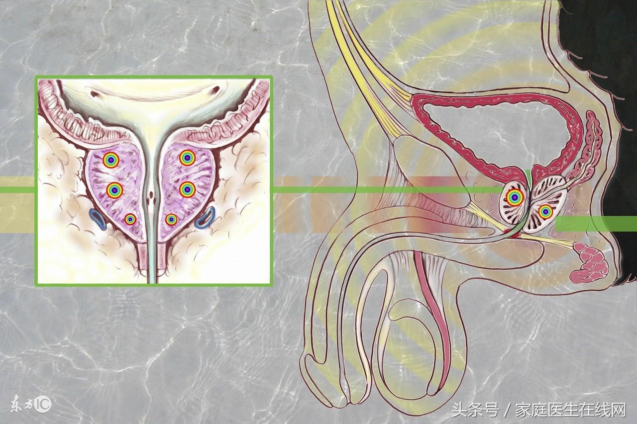 前列腺炎补硒还是锌