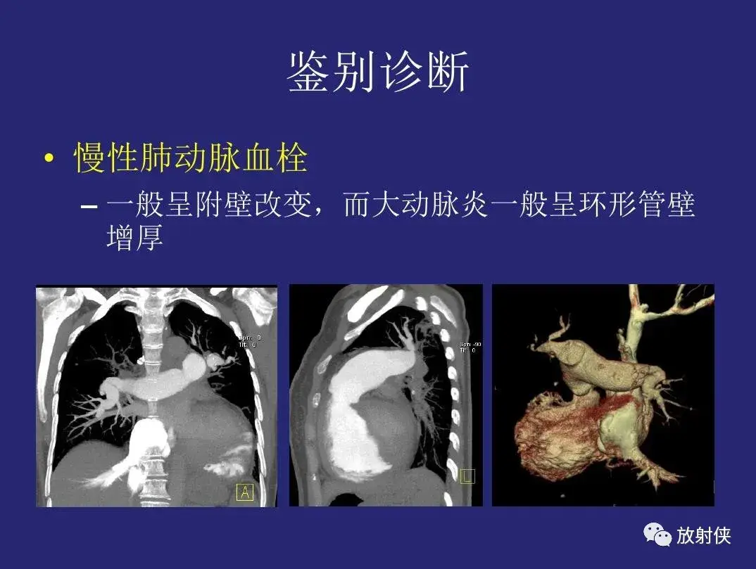 大动脉炎需要补硒吗