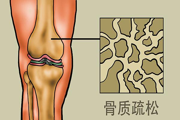 中年补钙什么钙片效果最好