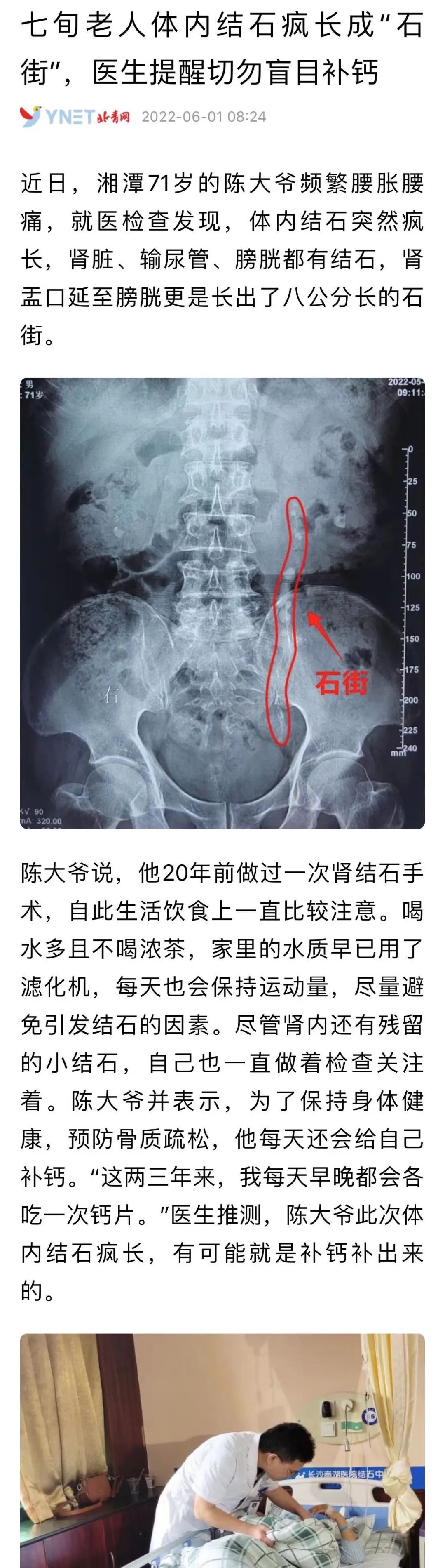 50岁补钙吃啥钙片好