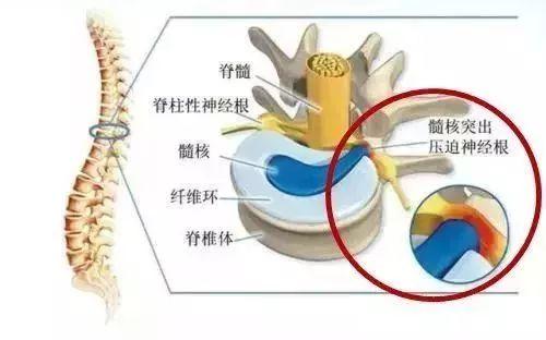 老年人腿抽筋吃什么钙片补钙最好