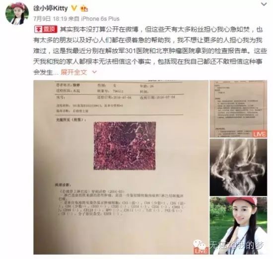 癌症可以吃硒维康吗