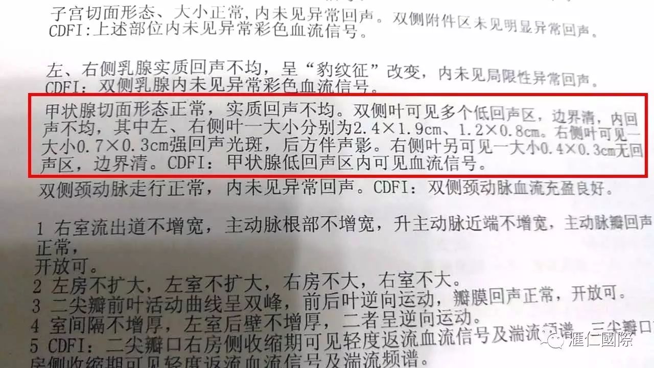 直肠癌能吃硒维康吗