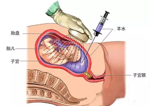 查微量元素需要空腹抽血吗