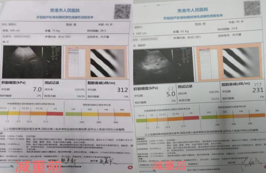 痛风可以吃锌硒宝吗