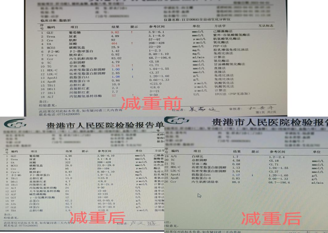 痛风可以吃锌硒宝吗