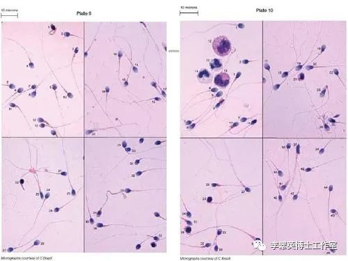 维生素e锌硒宝精子