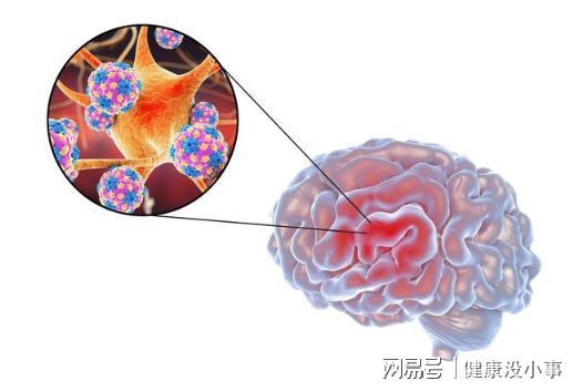 补硒对脑梗有没有作用