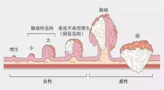 胃半切术后需要补硒吗