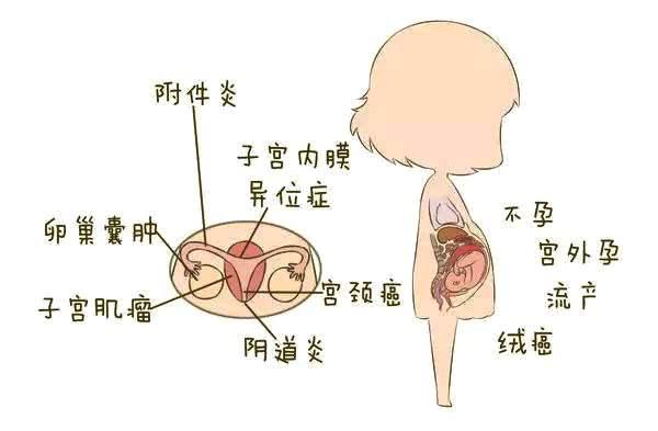 女人身体有炎症发生，宫颈癌找上门，吃维生素让HPV病毒落荒而逃