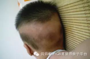 婴幼儿怎么补钙