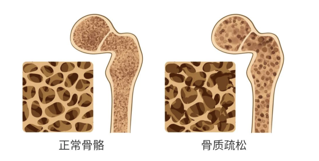 什么年龄补钙最好