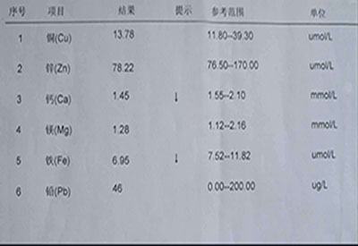 微量元素检测仪价格多少我要去医院做一次微量元素检查多少钱?