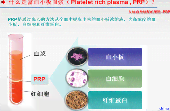 茶叶因子功效及应用-茶叶因子功效及应用