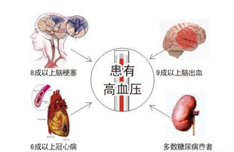 医生推荐三个防治高血压的食疗方法，最后一个最简单也最有效