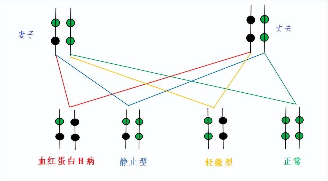 轻型地贫补铁会加重吗