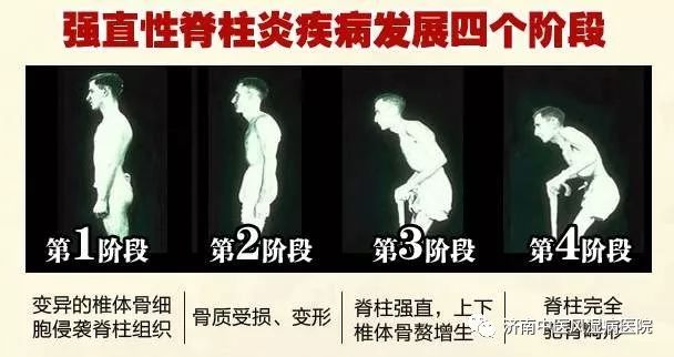 男人补钙增强性功能吗