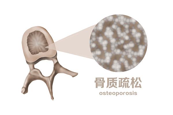 补钙空腹还是饭后吃