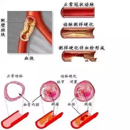 血液微量元素检查包括哪些