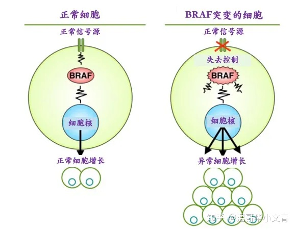 甲状腺全切后补钙方案