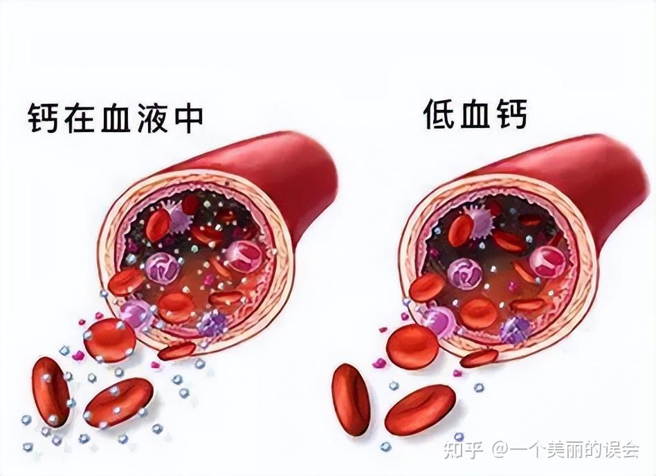 中老年补钙的最佳方法