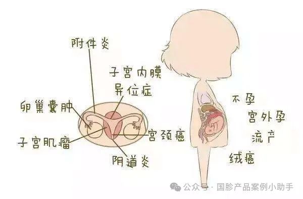 国珍产品含硒的有哪些