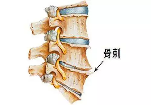 补钙对肩周炎有好处吗