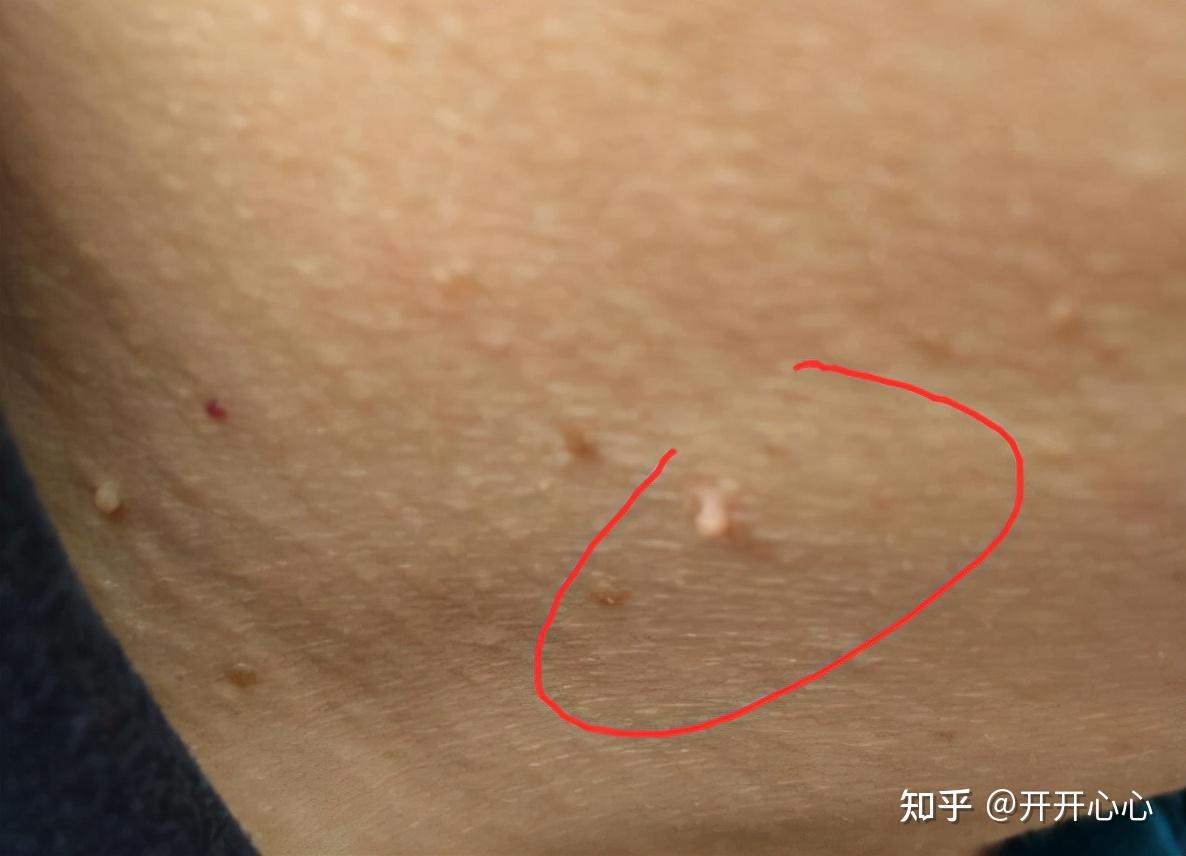 体恒健牌硒维康hpv