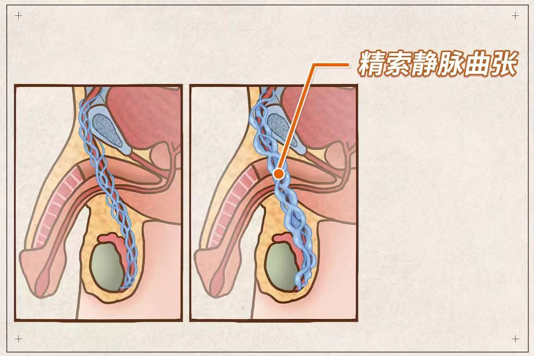 锌硒宝 吃多久 检查