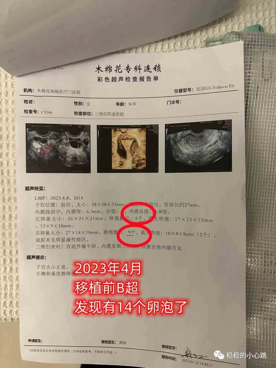 那种锌硒宝牌子备孕好