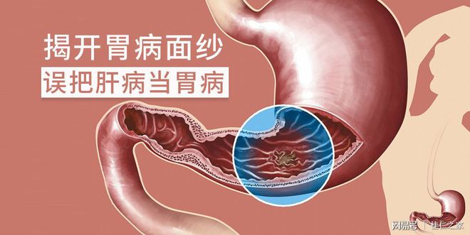 胃病患者到底要不要补硒