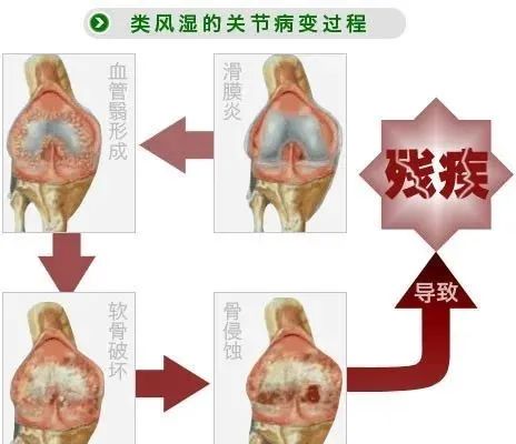 补硒的盐对补硒作用大吗